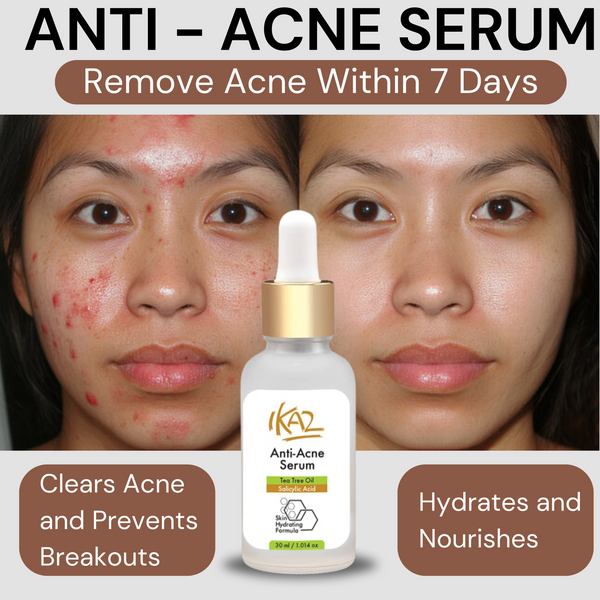 ANTI ACNE SERUM